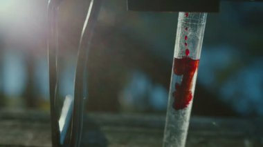 Dışarıdaki tüpte kan örneği var.