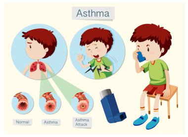 İnsan anatomisi ve sağlık astım illüstrasyon