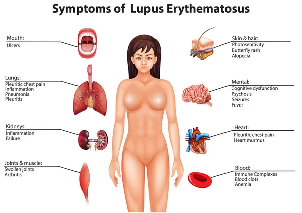 Uma Anatomia Humana Ilustração Órgão —  Vetores de Stock