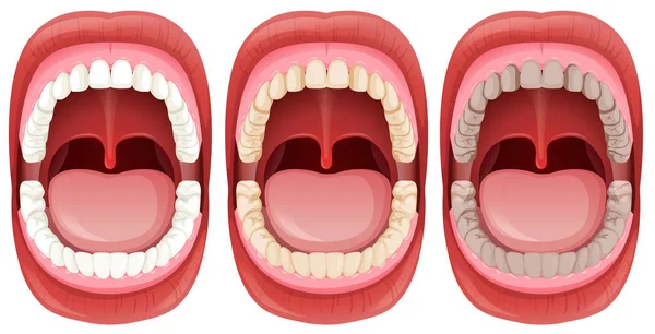 Set Human Mouth Anatomy Illustration — Stock Vector