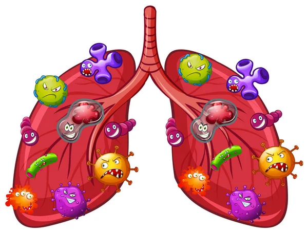Tüdő Baktériumok Vektor Illusztráció — Stock Vector
