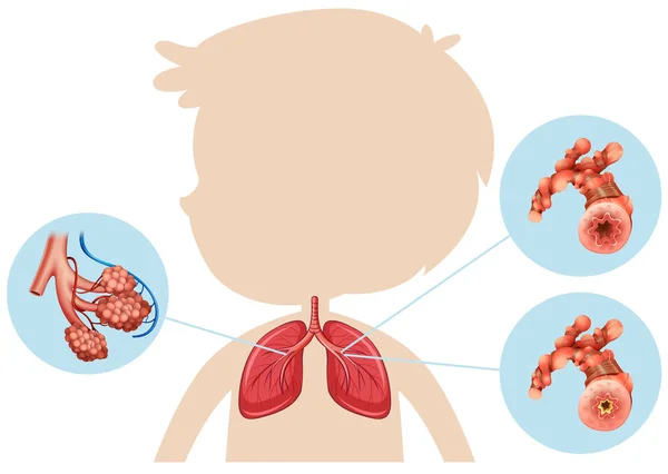 Anatomía Niño Ilustración Pulmonar — Vector de stock