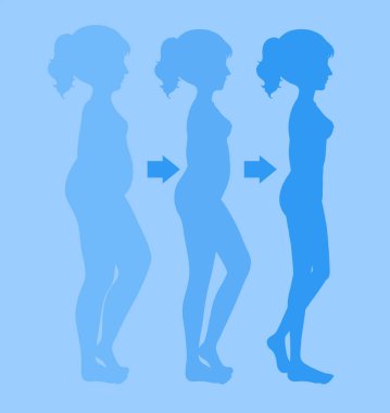 Bir genç kadın kaybetmek ağırlık illüstrasyon