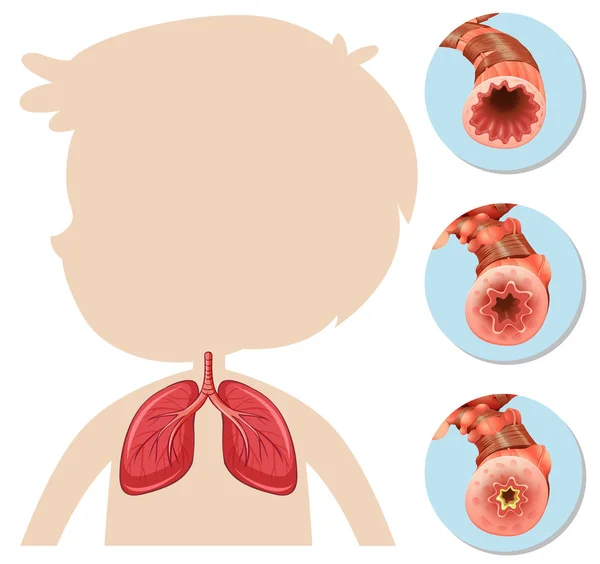 少年シルエット肺の解剖図 — ストックベクタ