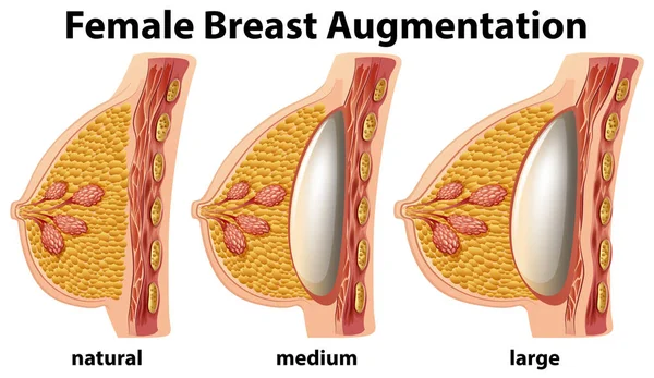 Boobs Size