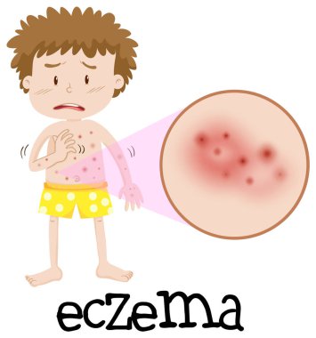 Büyütülmüş egzama çizim ile genç çocuk