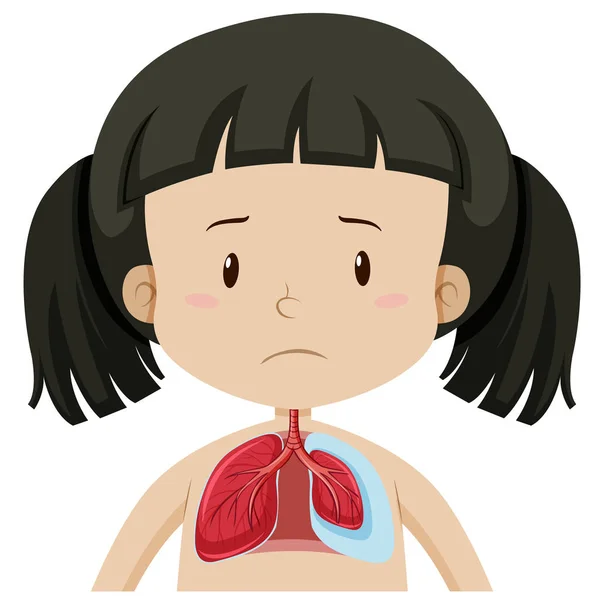Akciğerler Çizim Ile Genç Kız — Stok Vektör