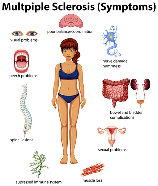 Een Illustratie Van Onderwijs Poster Van Multiple Sclerose — Stockvector