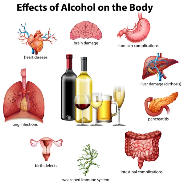酒精的作用在身体例证 — 图库矢量图片