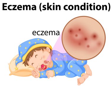 Bir bebek egzama olan yüz şekil üzerinde
