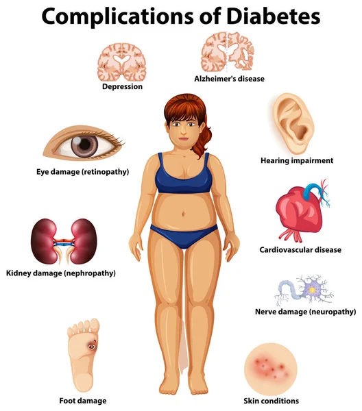Una Ilustración Las Complicaciones Diabetes — Archivo Imágenes Vectoriales