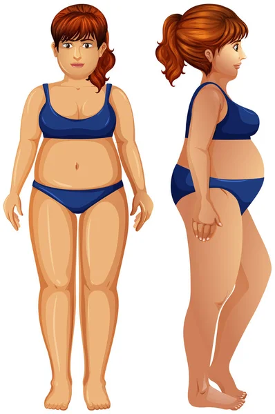 Een Illustratie Van Figuur Overgewicht Vrouw — Stockvector