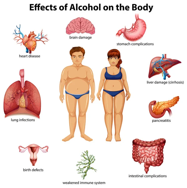 Effetti Dell Alcol Sull Illustrazione Del Corpo — Vettoriale Stock