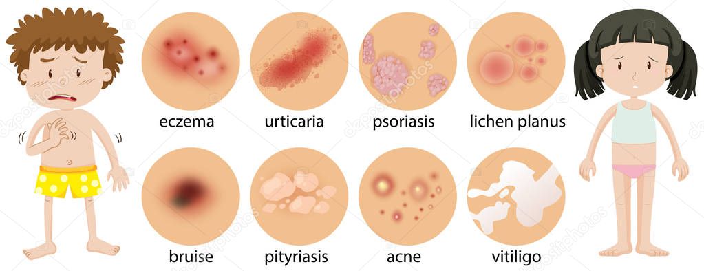 Young children with different skin conditions illustration