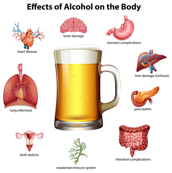 Efectos Del Alcohol Ilustración Corporal — Archivo Imágenes Vectoriales