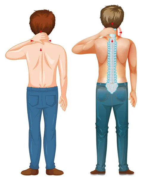 Homem com dor nas costas no fundo branco — Vetor de Stock