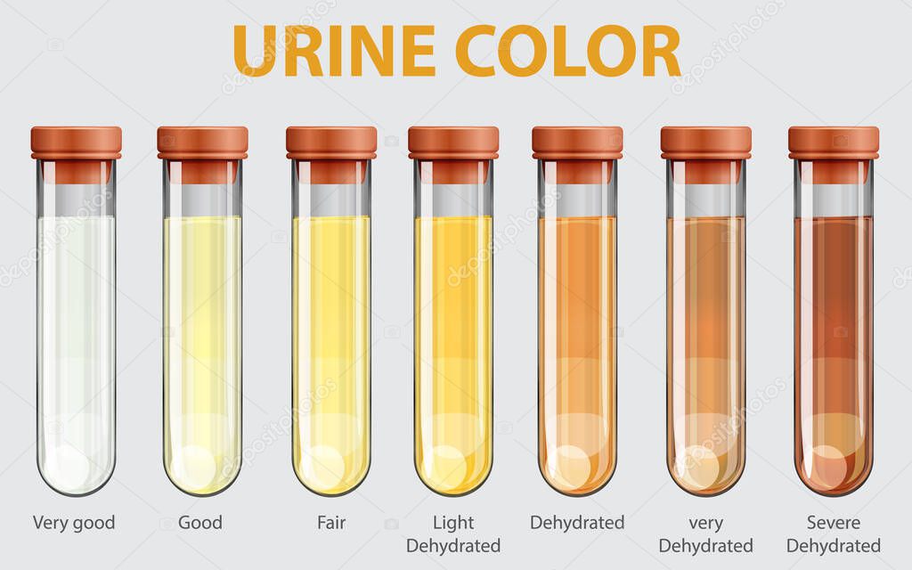 Illustration of urine color chart illustration
