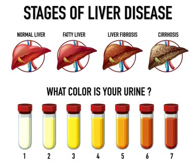 Karaciğer hastalığı çiziminin aşamaları