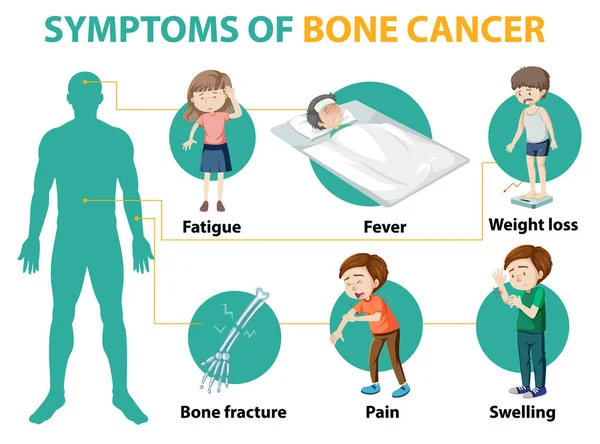 Medical Infographic Bone Cancer Symptoms Illustration — Stock Vector
