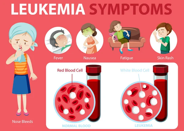 Leucemia Sintomas Desenho Animado Estilo Infográfico Ilustração — Vetor de Stock