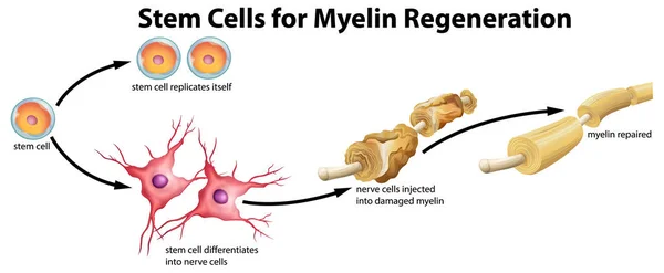 Stem Cell Myelin Regeneration Illustration — Stock Vector