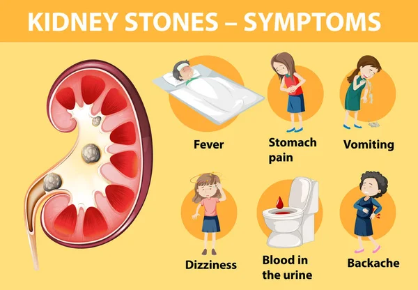 Sintomi Calcoli Renali Stile Cartone Animato Illustrazione Infografica — Vettoriale Stock