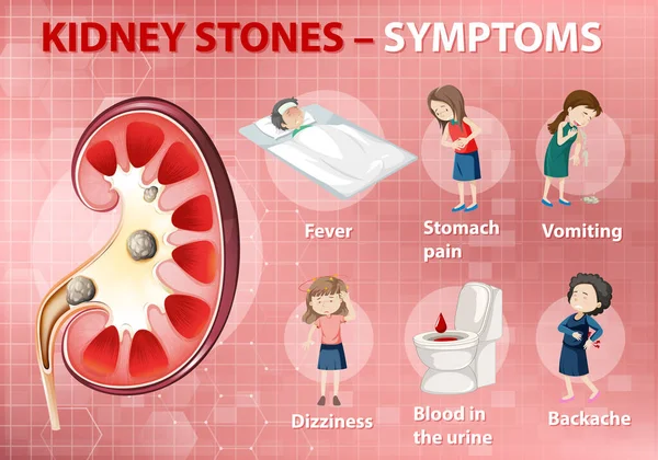Kidney Stones Symptoms Cartoon Style Infographic Illustration — Stock Vector