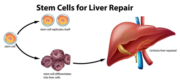肝修复用干细胞图例 — 图库矢量图片