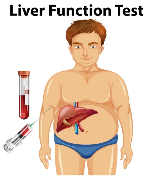 一套人体肝功能测试教育图例 — 图库矢量图片