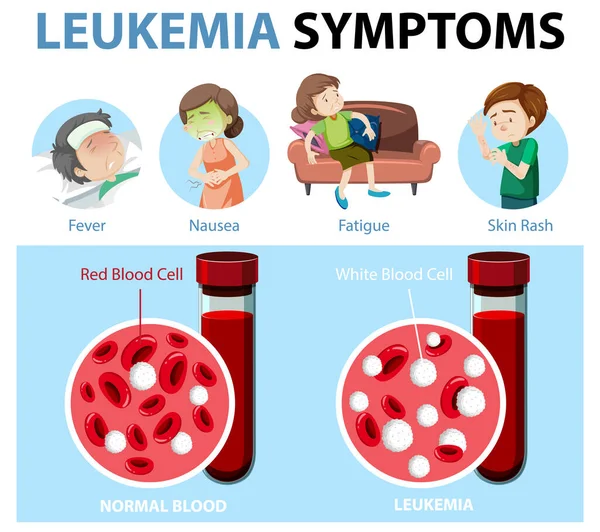 Leukemia Symptoms Cartoon Style Infographic Illustration — Stock Vector