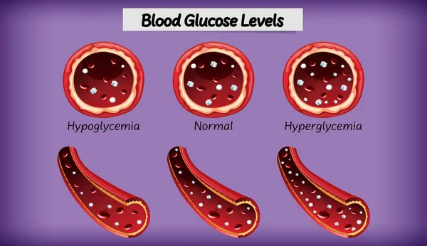 Medische Bloedglucosespiegel Illustratie — Stockvector