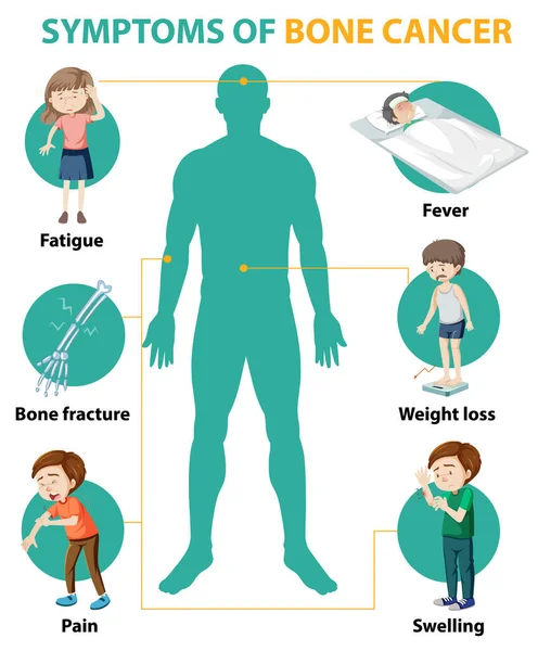 Medical Infographic Bone Cancer Symptoms Illustration — Stock Vector