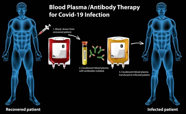 Plasma Sanguíneo Terapia Anticorpo Para Infecção Por Covid Ilustração Infográfica —  Vetores de Stock