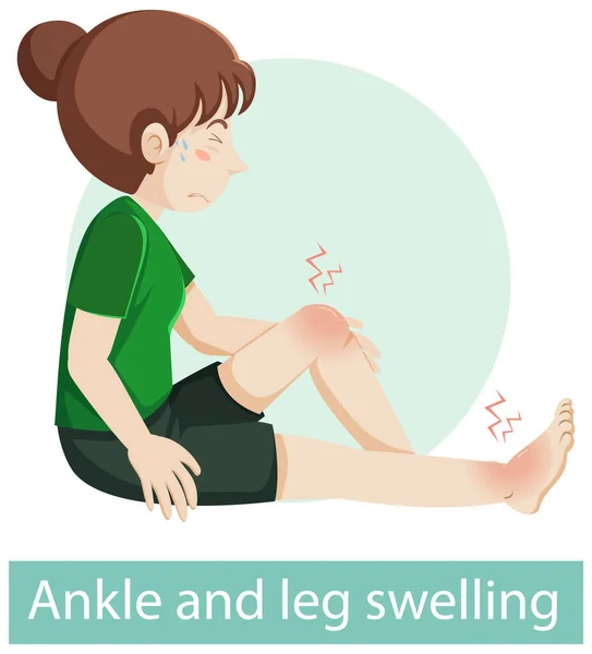 足首と脚の腫れ症状の漫画のキャラクターイラスト — ストックベクタ