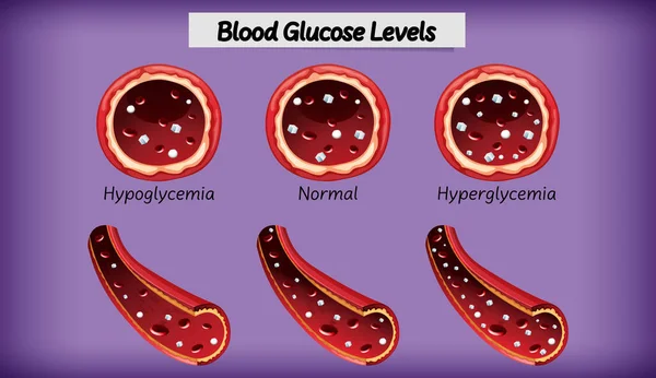 Medyczny Poziom Glukozy Krwi Ilustracja — Wektor stockowy