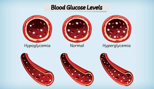 Illustrazione Del Livello Glucosio Nel Sangue Medico — Vettoriale Stock