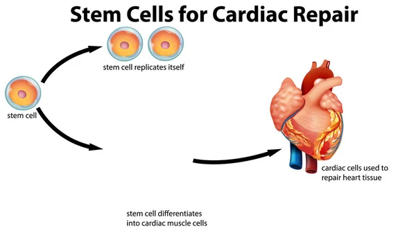 心脏修复用干细胞图解 — 图库矢量图片