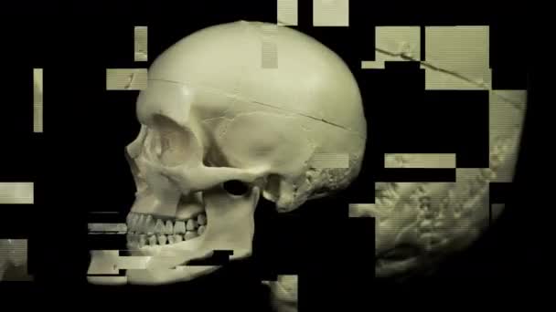 Cráneo Girando Contra Negro Con Efectos Falla Internacional — Vídeo de stock
