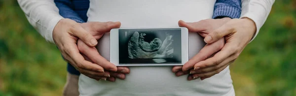 Hombre mostrando ultrasonido sobre su vientre esposas — Foto de Stock