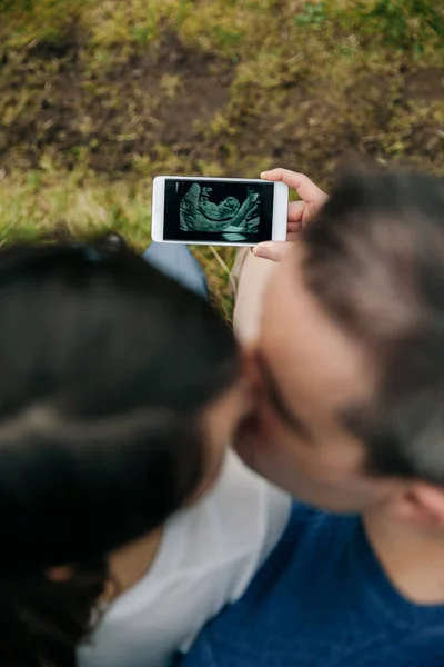 Incinta guardando ultrasuoni sul cellulare con il marito e baciare — Foto Stock