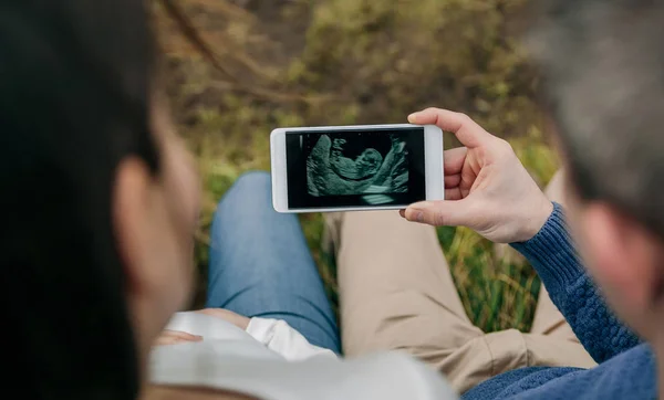 Enceinte regardant l'échographie sur le mobile avec son mari — Photo