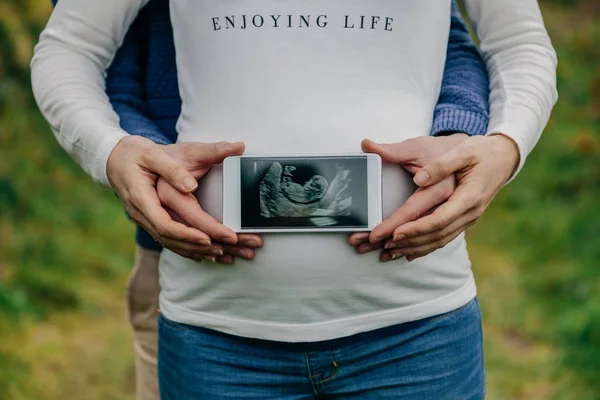 Muž ukazuje ultrazvuk na bříšku manželky — Stock fotografie