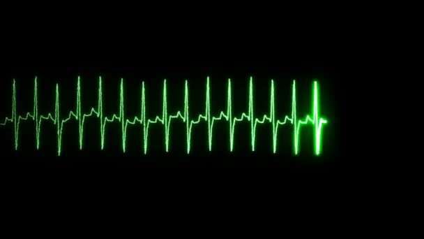 Batimento Cardíaco Sinal Pulso Tela — Vídeo de Stock