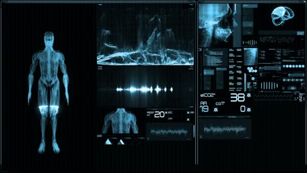 Écran Futuriste Bleu Moniteur Patient Perspective Interface Écran Médical Écran — Video