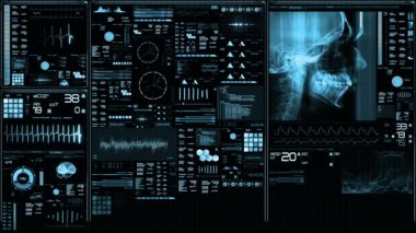 Mavi fütüristik hasta monitör ekran perspektif / tıbbi ekran arayüzü. Çeşitli parametreleri ile ölçülen perde. ST-segment ve kalp krizi algılama, pace-maker analiz ve aritmi analizi, sağlık kurtarma sistemi.  