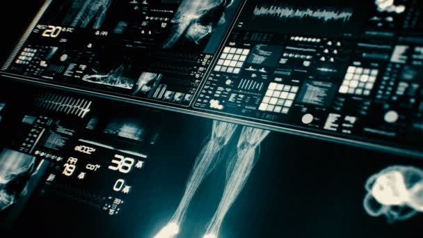 Futuristischer Patientenbildschirm Perspektive Medizinischer Bildschirmoberfläche Bildschirm Mit Verschiedenen Parametern Gemessen — Stockvideo