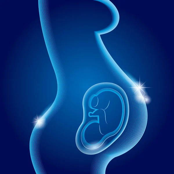 Röntgen Vuxen Gravid Kvinna — Stock vektor