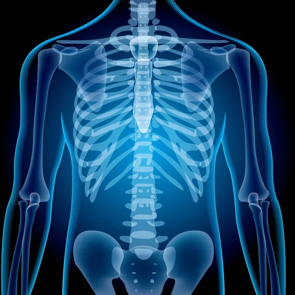 Gerçekçi Iskelet Röntgen Çekim — Stok Vektör
