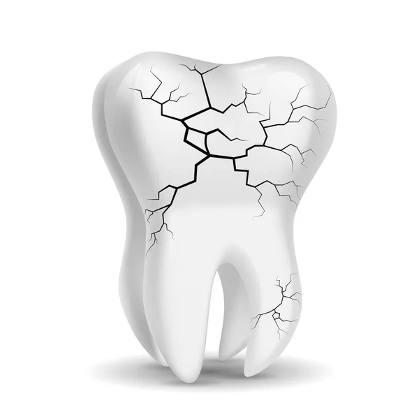 Dientes Extraídos Vectores Enfermedad Dental Aislado Sobre Fondo Blanco — Vector de stock