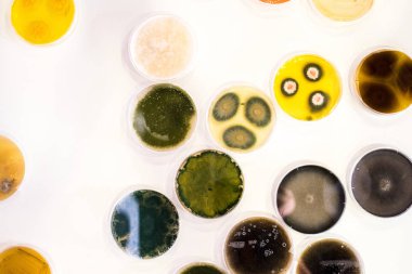 Culture of bacteria in petri dish clipart